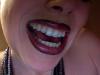 teeth1